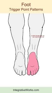 Pin On Achilles Trndon
