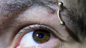 An eyebrow piercing is a hole in your eyebrow. My Eyebrow Piercing Is Rejecting It Ripped Out Youtube