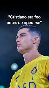 Cristiano Ronaldo era feo antes de operarse?