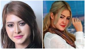 Kilafairy dilahirkan pada 17 mei 1992 di kuala lumpur. 15 Artis Wanita Dituduh Pernah Melakukan Pembedahan Plastik Farhana Jafri