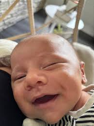 Hi all, Has anyone used this product before? My 4-week-old baby has started  getting a lot of baby acne. I know people say it usually goes away