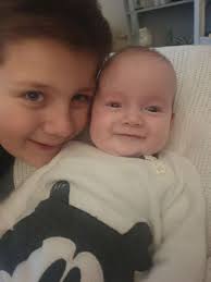 Tiny Scots baby with rare skull condition set for life-changing surgery to  reshape his head