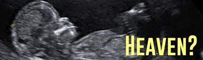 Question Do Miscarried Babies Go To Heaven Spirit Of Joy