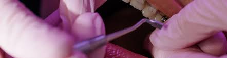 Crooked Teeth | Kowhai Dental