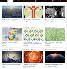 However, the exact cause is not known. 25 Anos De Tratamiento De La Esclerosis Multiple