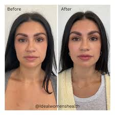 Ideal Women's Health Specialists