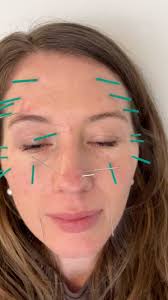 Work in progress ☯️ Using myself as an ongoing cosmetic acupuncture case  study 🤗 #notox #notoxbotox #cosmeticaxupuncture #natural #ageinggracefully  #smilelines #real #selfcare