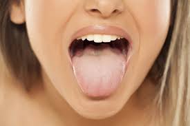 Consider what is the leukoplakia of the cervix, how to treat it and why it develops. Now Treat All Symptoms Of White Tongue Naturally With This Comprehensive Guide By Mila Jones Fit Yourself Club