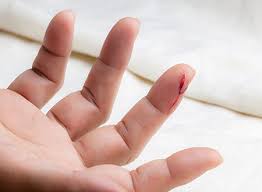 Image result for Tetanus