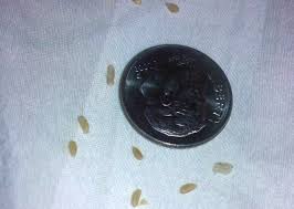 What Appeared To Be Sesame Seeds Are Likely Tapeworm Segments What S That Bug