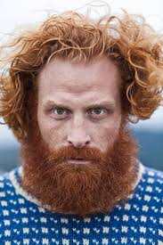 Is ginger beard specifically an Irish trait?