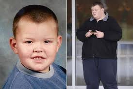 Pria 'Tergemuk' di Inggris Ini Meninggal di Usia 22 Tahun, Diduga Sakit  Jantung