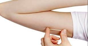 How long does the contraceptive implant last? What Is Your Experience With Nexplanon Quora