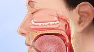 He is having nose bleeds daily, many times with a lot of clotting and discharge. Nasal Polyps San Diego Nasal Inflamation Chula Vista