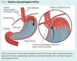 Effects Of Bedrest 3 Gastrointestinal Endocrine And Nervous Systems Nursing Times