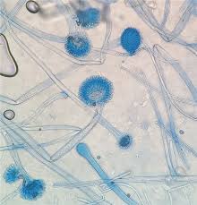 Aspergillus flavus aspergillus flavus produces the carcinogenic mycotoxin, aflatoxin which often contaminates foods such as nuts. Aspergillus Flavus Creative Biolabs