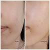 If you have similar skin and also has a budget for skincare, try using this. 1
