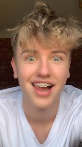 Dan Woolley Brace Reveal