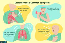 Costochondritis Chest Pain In Fibromyalgia