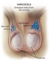 Image result for Testicle