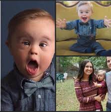 I don't care what anyone says, I think he deserves all the love we can give  him! ❤️ An agency refused to let boy this beautiful boy with Down syndrome  model their