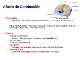 Check spelling or type a new query. Trastornos Del Lenguaje Tema 10