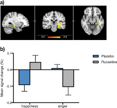 Please don't assume prozac (fluoxetine) should be your sole treatment of depression. A Single Dose Of Fluoxetine Reduces Neural Limbic Responses To Anger In Depressed Adolescents Translational Psychiatry