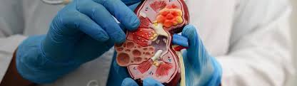 Image result for Acute Pyelonephritis