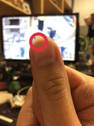 We did not find results for: Matt Bragg On Twitter After Rtx 2016 I Noticed I Had A Black Spot Under My Nail After Rtx This Year It S Back What Kind Of Curse Is This And Who S Responsible