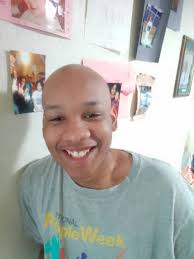 Can someone give him some hair?