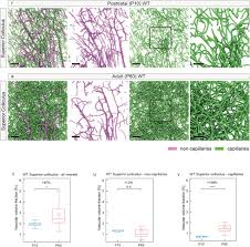 Some people having pain in their left rib and breast this is because of costochondritis. Hierarchical Imaging And Computational Analysis Of Three Dimensional Vascular Network Architecture In The Entire Postnatal And Adult Mouse Brain Biorxiv