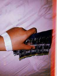Sama seperti prosedur medis pada umumnya, tangan di infus juga dapat menimbulkan efek samping. 15 Ide Infus Fotografi Foto Tangan Gambar