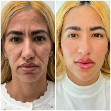 Virgen Maria dame siempre Puntería 😂😂😂😂 #prp #facials #antiaging  #celulasmadres #glowup #westpalmbeach
