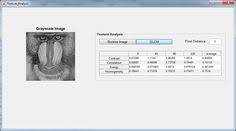 Texture Analysis Gray Level Co Occurrence Matrix Glcm Gui Matlab Matrix