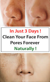 Get A Clean Face Free Of Pores Using This Amazing Natural Ingredient Skincaretipsforteens Clean Face Skin Care Tips Natural Skin Care