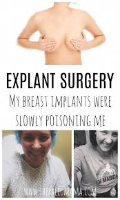 Pin On Explant Surgery