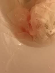 When the amniotic sac bursts, there is a popping sound, according to baby center. Did My Water Just Break Pic Warning March 2019 Babies Forums What To Expect