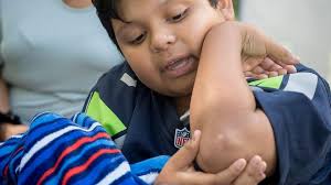 Kings Park boy describes being hit by SUV at school bus stop