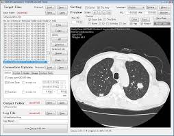 Dicom stands for 'digital imaging and communications in medicine'. Top 15 Free Dicom Viewers