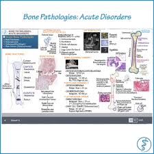 Here S The Final Image From One Of Our Pathology Tutorials Visit Our Site For The Full Demo Draw Along With Us On Medical Science Pathology Medical Anatomy
