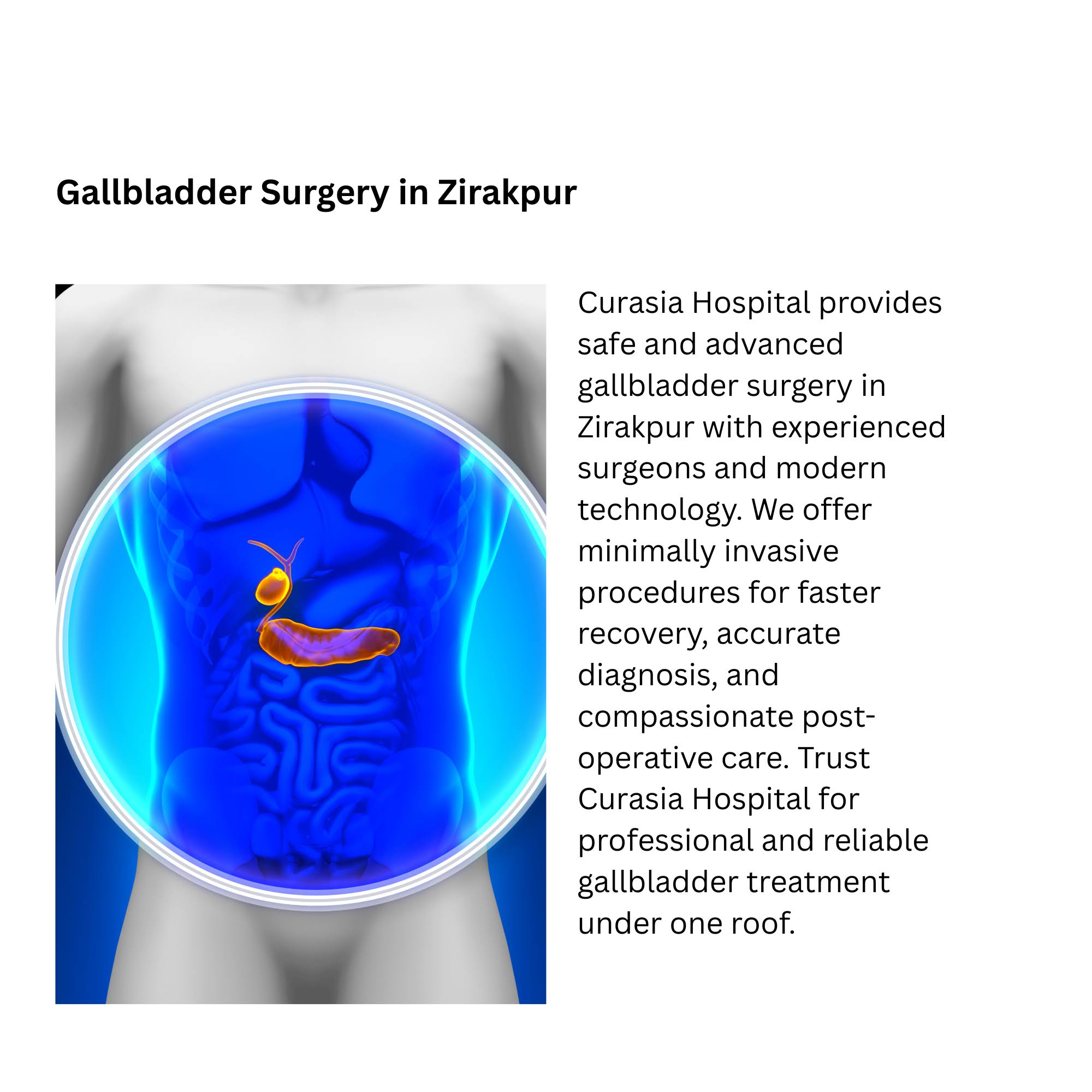 Gallbladder Surgery in Zirakpur product image
