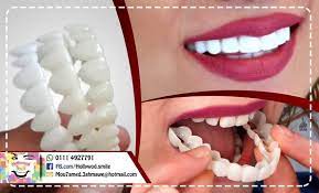 ابتسامة هوليوود hollywood smile home facebook