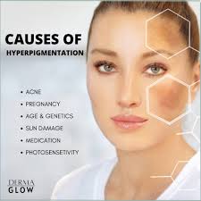 DermaGlow by Dania Khalifeh (@dermaglow.lb) · Instagram 照片和视频