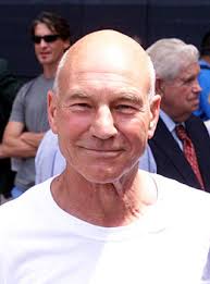 La perte de cheveux s'étend ensuite au vertex correspondant au haut du crâne jusqu'à un aspect de tonsure quand il ne reste plus que des cheveux sur les côtés et l'arrière. Alopecie Wikipedia