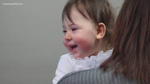 Meet Abigail, a girl who underwent 3 brain surgeries before her first  birthday
