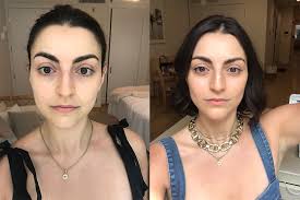Black hair is dramatic, but the dye can be very difficult to remove. The Best Dark Circle Treatment Is A Daily Zap Of Into The Gloss