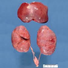 Autosomal Recessive Polycystic Kidney Disease Arpkd Is One Of Many Paediatric Cystic Renal Diseases Polycystic Kidney Disease Kidney Disease Renal Disease