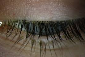 Image result for Blepharis affinis