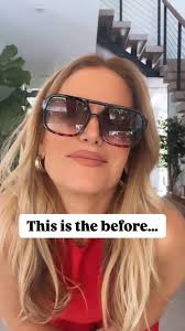 Ready for The Upgrade? View bio for details, ✨, Because deep down…you know  this is your before., The confident, radiant, unapologetic version of you?,  She’s closer than you think—and she’s ready to ...