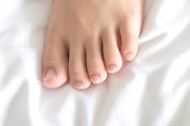 Image result for Koilonychia feet